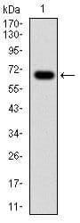 Monoclonal Mouse anti-Human G6PD Antibody (clone 5E+12, IHC, WB)