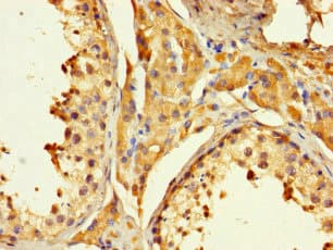 PAGE1 Antibody