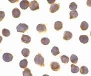 Polyclonal Rabbit anti-Human CFLAR / FLIP Antibody (WB)