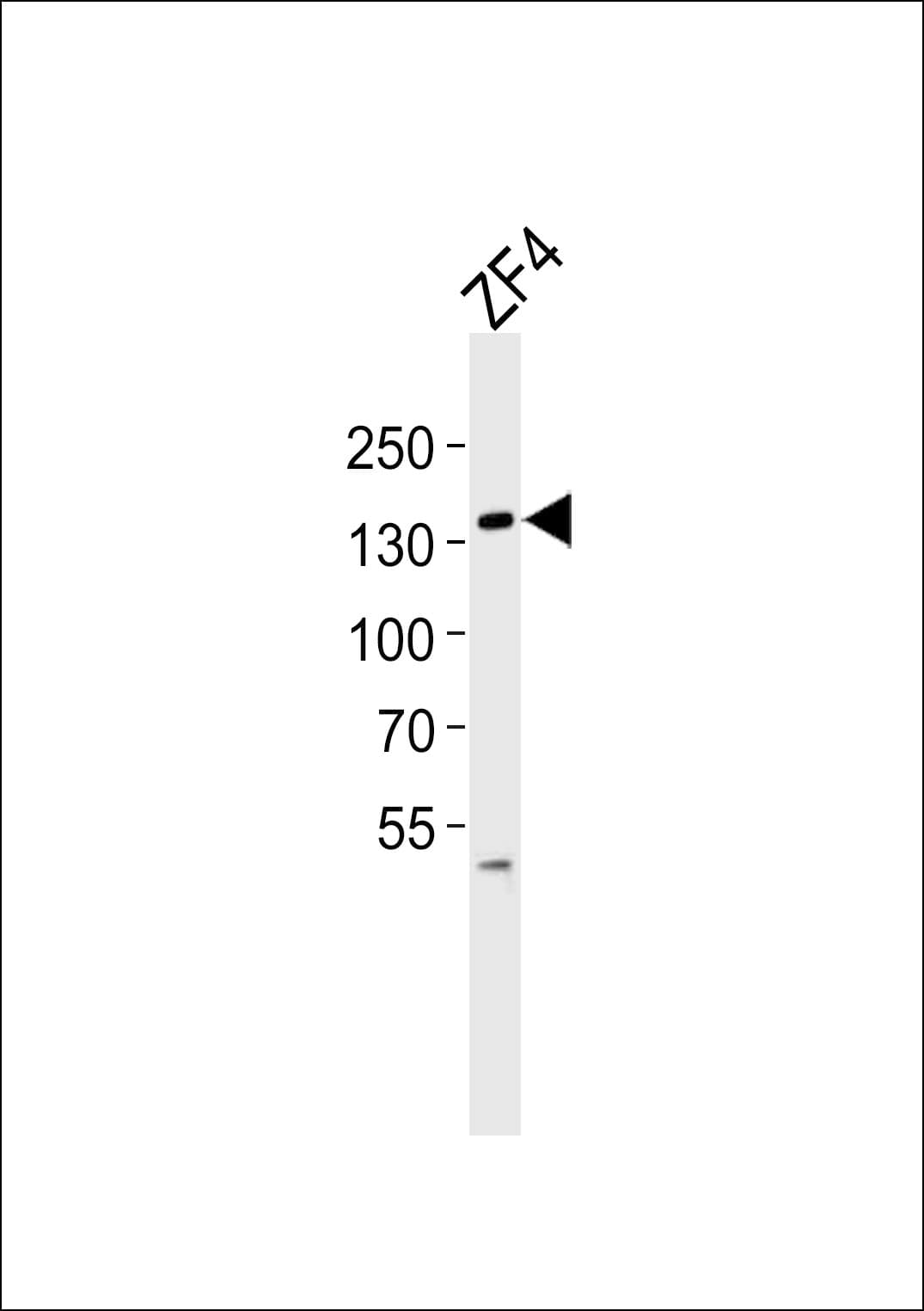 Polyclonal Rabbit anti-Zebrafish PKN2 Antibody (aa108-141, WB)