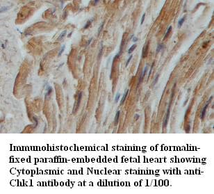 IHC-plus™ CHEK1 / CHK1 Antibody