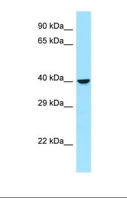 RRAGB / RAGB Antibody (C-Terminus)