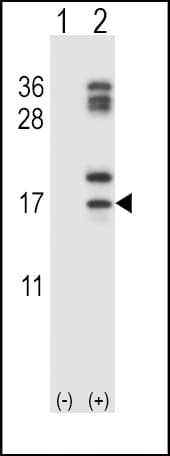 CLC Antibody (aa95-124)