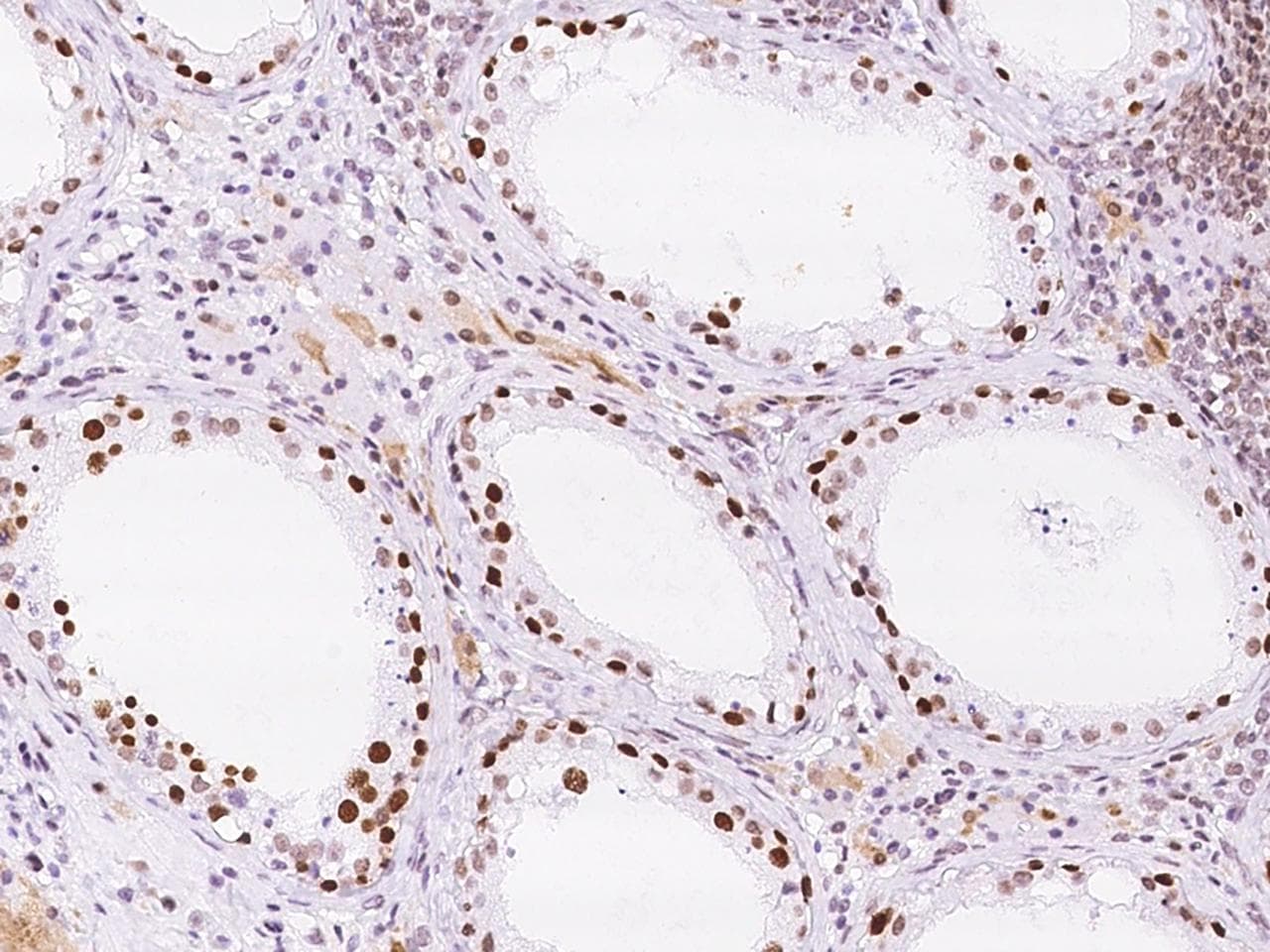 KLF17 Antibody (Preservative Free)
