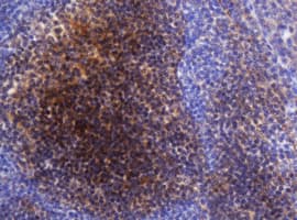Selenium Binding Protein 1 Antibody (clone OTI3D2)