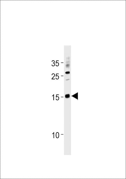 SSNA1 Antibody (aa25-53)