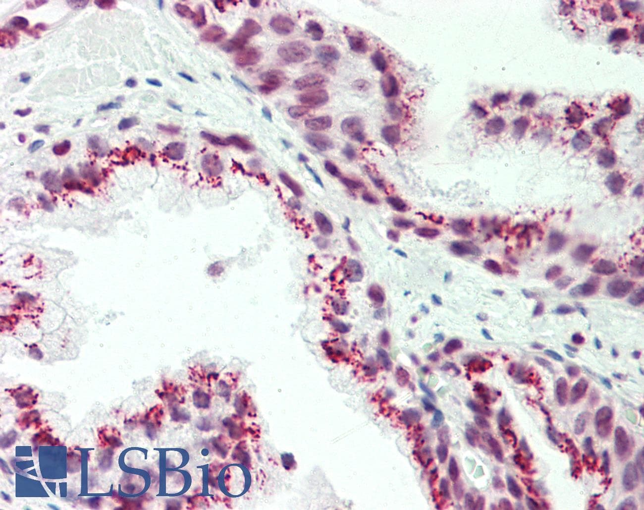 IHC-plus™ CASC4 Antibody (aa336-365)