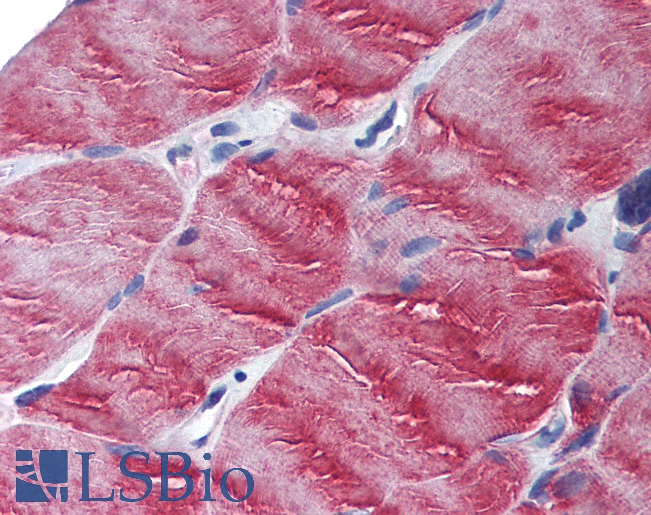 IHC-plus™ MYO5B / Myosin VB Antibody (N-Terminus)