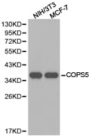 Polyclonal Rabbit anti-Human COPS5 / JAB1 Antibody (IHC, WB)