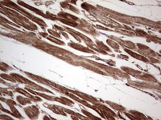TACC2 Antibody (aa727-1026, clone OTI1C3, Carrier-free)