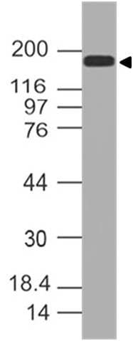 TOP2A / Topoisomerase II Alpha Antibody