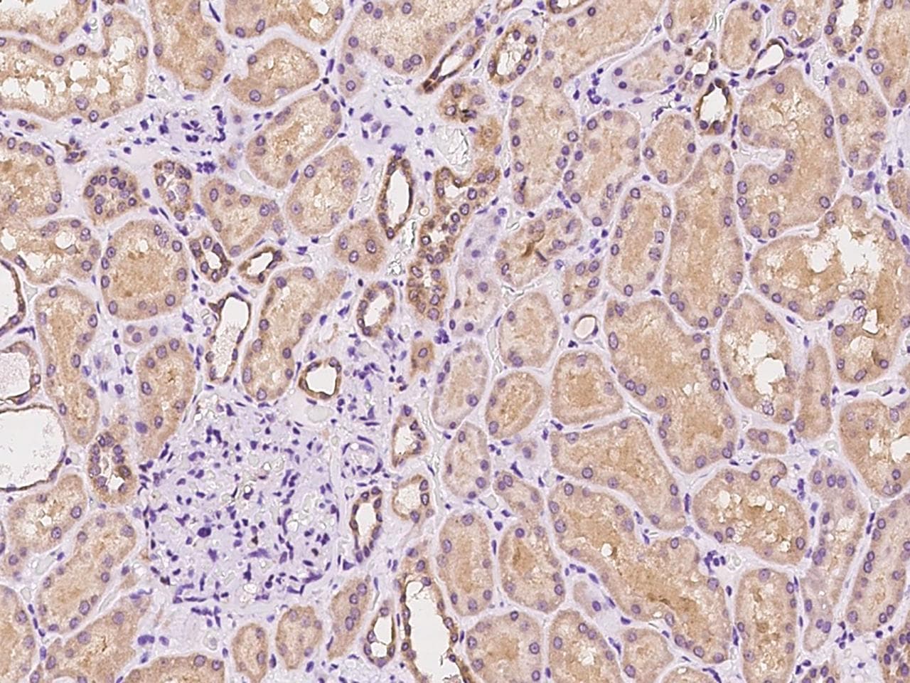 Polyclonal Rabbit anti-Human TNK2 / ACK1 Antibody (IHC)