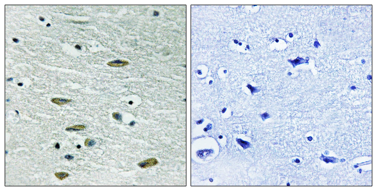 IGF1R / IGF1 Receptor Antibody (aa1311-1360)