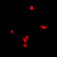 ZNF397 Antibody (N-Terminus)