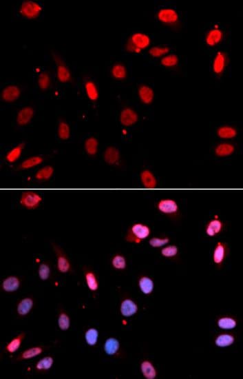 Polyclonal Rabbit anti-Human RAD18 Antibody (IHC, IF, WB)