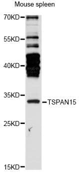 Polyclonal Rabbit anti-Human TSPAN15 Antibody (WB)