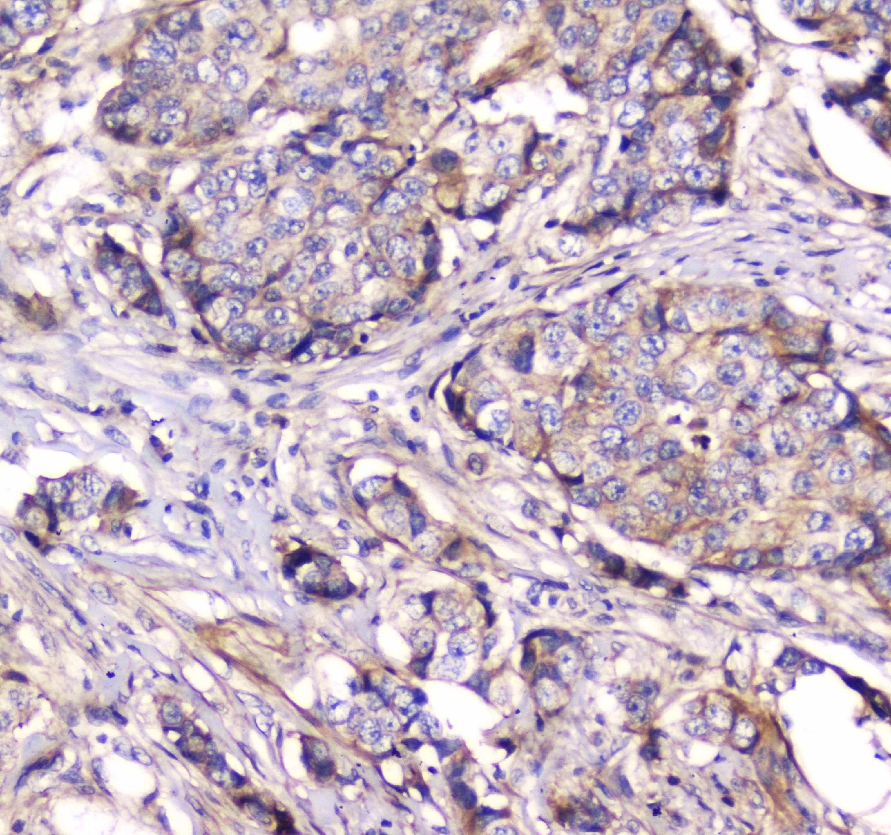 DNM1 / Dynamin Antibody