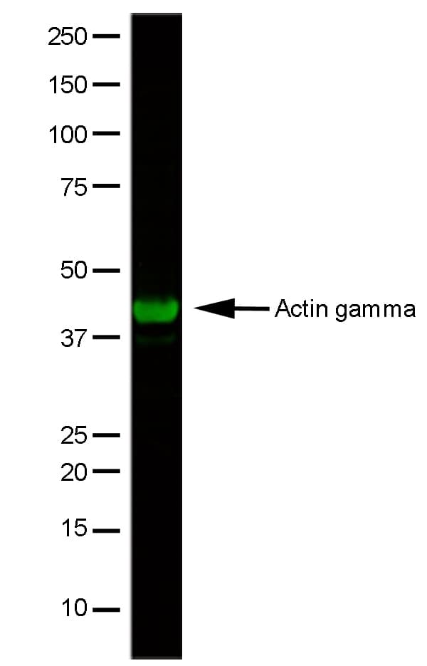 IHC-plus™ Monoclonal Mouse anti-Human ACTG1 / Gamma Actin Antibody (clone 2A3, N-Terminus, IHC, IF, WB)