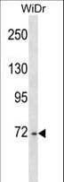 DDX4 / VASA Antibody (aa103-131)
