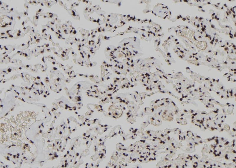 XPO4 / Exportin 4 Antibody