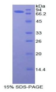 Human AGT / Angiotensinogen Protein (Recombinant His-GST)