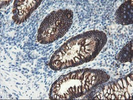 SRPRB Antibody (clone OTI1D9)