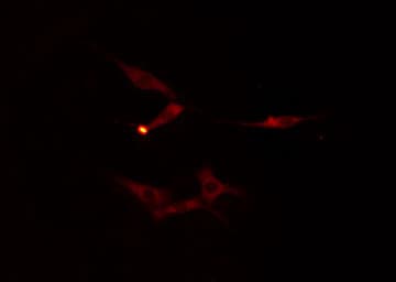 FZD9 / Frizzled 9 Antibody