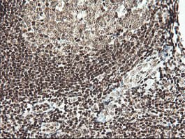 MCTS1 Antibody (aa1-181, clone OTI2F9)