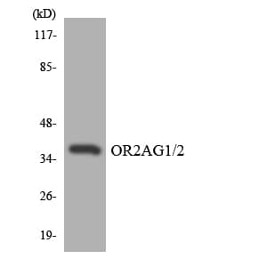 Polyclonal Rabbit anti-Human OR2AG1 + OR2AG2 Antibody (aa45-94, WB)