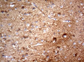 NUMB Antibody (aa1-365, clone OTI2B9)
