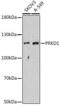 PRKD1 / PKC Mu Antibody