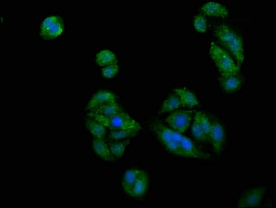 PICALM / CALM Antibody