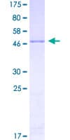 Human 5-Alpha Reductase / SRD5A1 Protein (Recombinant GST)