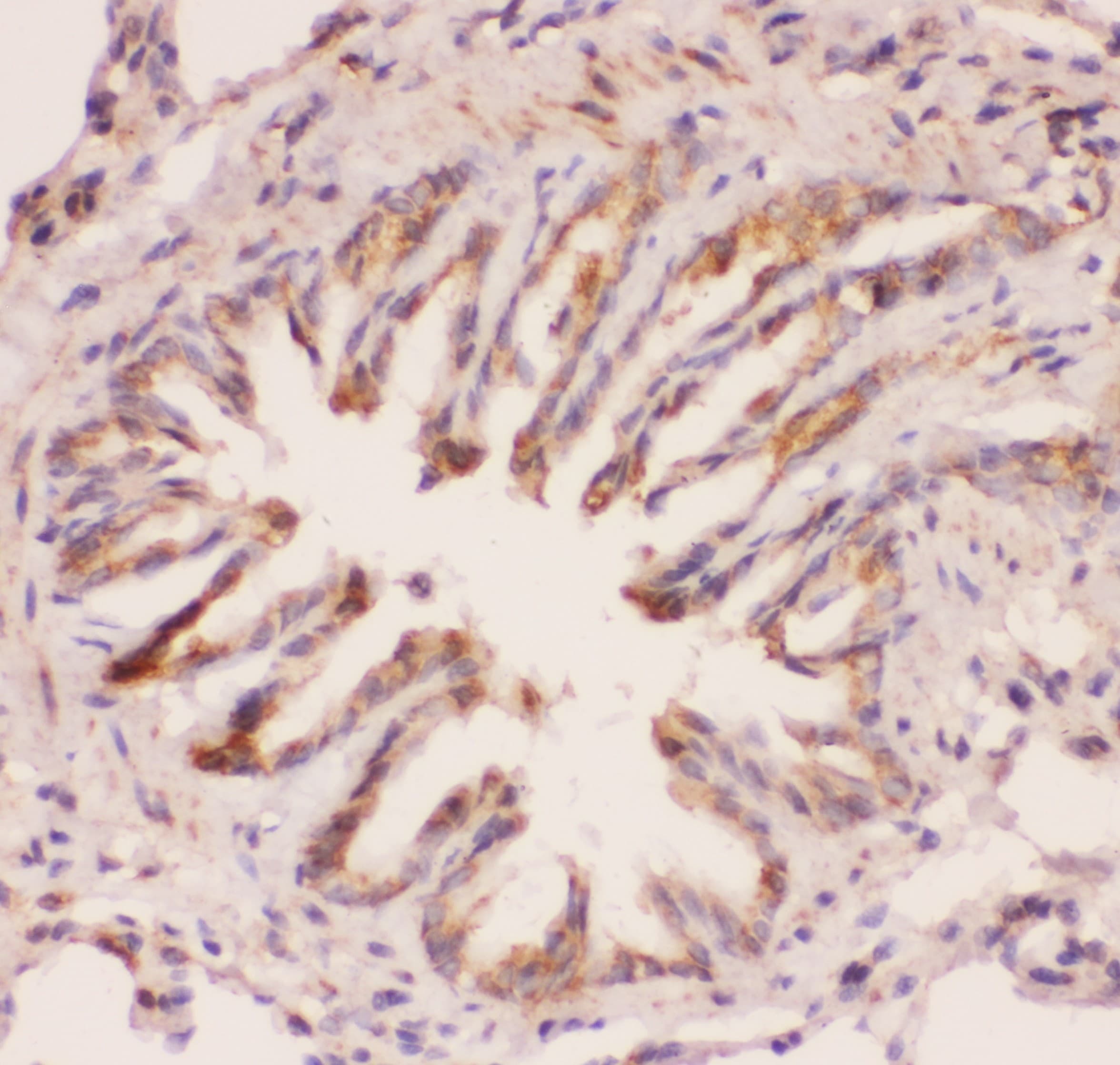 Polyclonal Rabbit anti-Human MYD88 Antibody (aa44-264, IHC, WB)