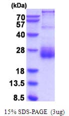 Human SPINT2 / HAI-2 Protein (Recombinant His)