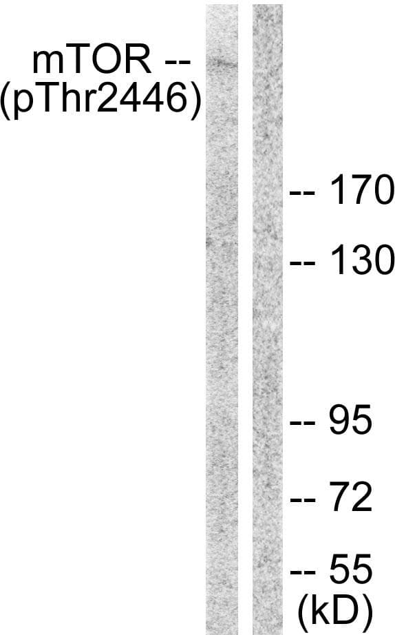 Polyclonal Rabbit anti-Human MTOR Antibody (phospho-Thr2446, WB)