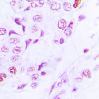 KAT2A / GCN5 Antibody (C-Terminus)