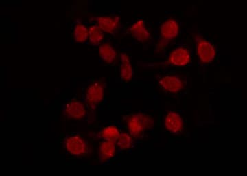Polyclonal Rabbit anti-Human ZRANB2 / ZNF265 Antibody (IF, WB)