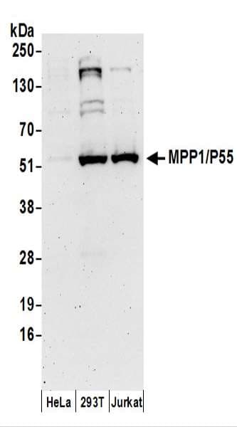 MPP1 Antibody (aa1-50)