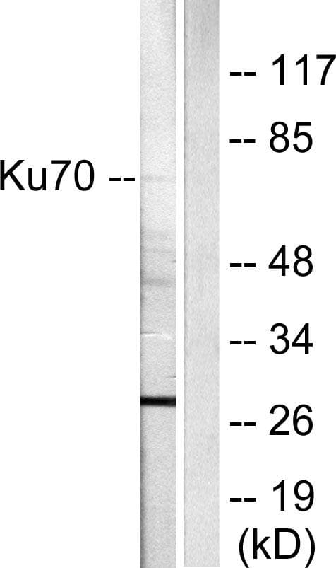 XRCC6 / Ku70 Antibody