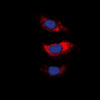 Polyclonal Rabbit anti-Human MARCKS Antibody (Internal, IF, WB)