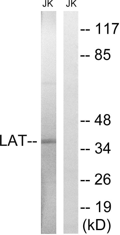 Polyclonal Rabbit anti-Human LAT Antibody (p161, WB)