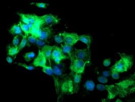 SLA2 / SLAP2 Antibody (clone OTI2G3)