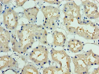 DCUN1D1 / SCCRO Antibody (aa1-259)