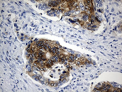M-PST / STM Antibody (clone OTI1E8, Carrier-free)