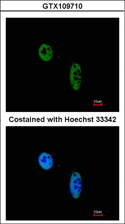Polyclonal Rabbit anti-Human RAG2 / RAG-2 Antibody (aa271-527, IHC, WB)