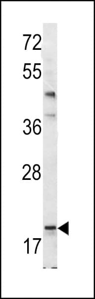 BAD Antibody (aa92-127)
