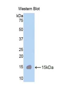 CUBN / Cubilin Antibody (aa3511-3623, HRP)
