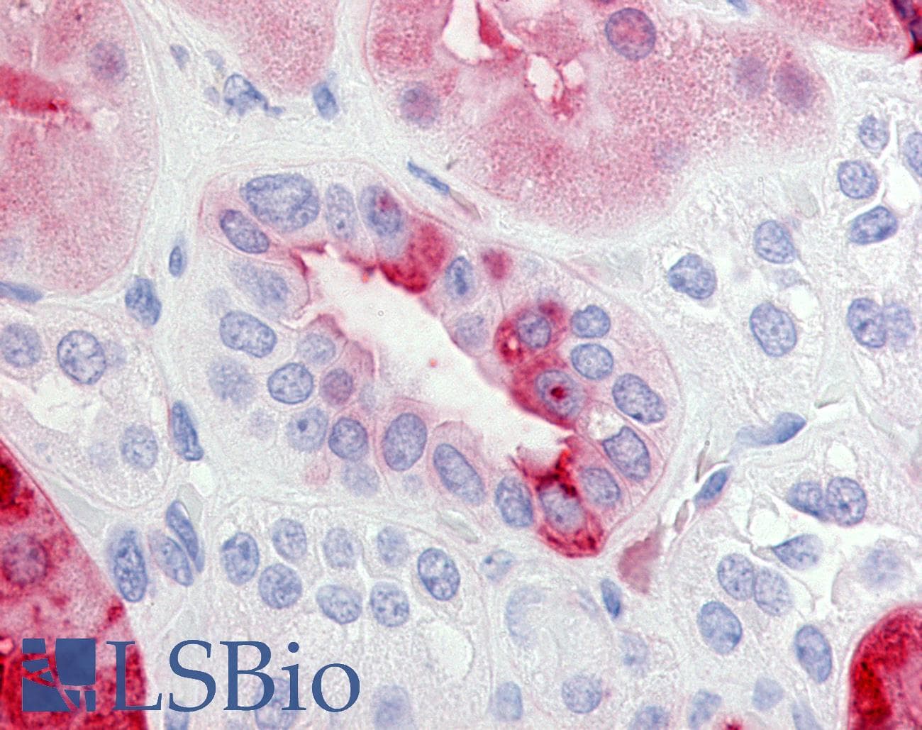 IHC-plus™ Polyclonal Rabbit anti-Human PTGER2 / EP2 Antibody (C-Terminus, IHC)