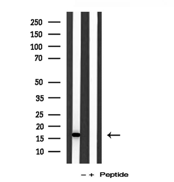 Polyclonal Rabbit anti-Human IFT20 Antibody (IHC, WB)